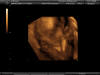 ultrasound 24 weeks - baby "a"