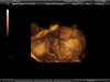 ultrasound 24 weeks - baby "b"